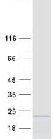 Human ASF1B Protein (Recombinant Myc-DDK (Flag))