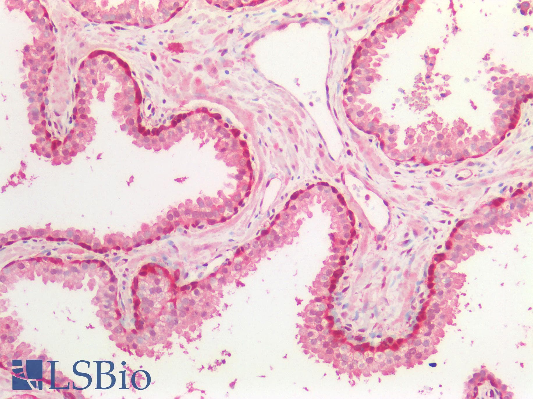 PathPlus™ GSTP1 / GST Pi Antibody (clone OTI4B6)