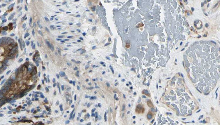 Polyclonal Rabbit anti-Human CAMK2A / CaMKII Alpha Antibody (IHC, IF, WB)