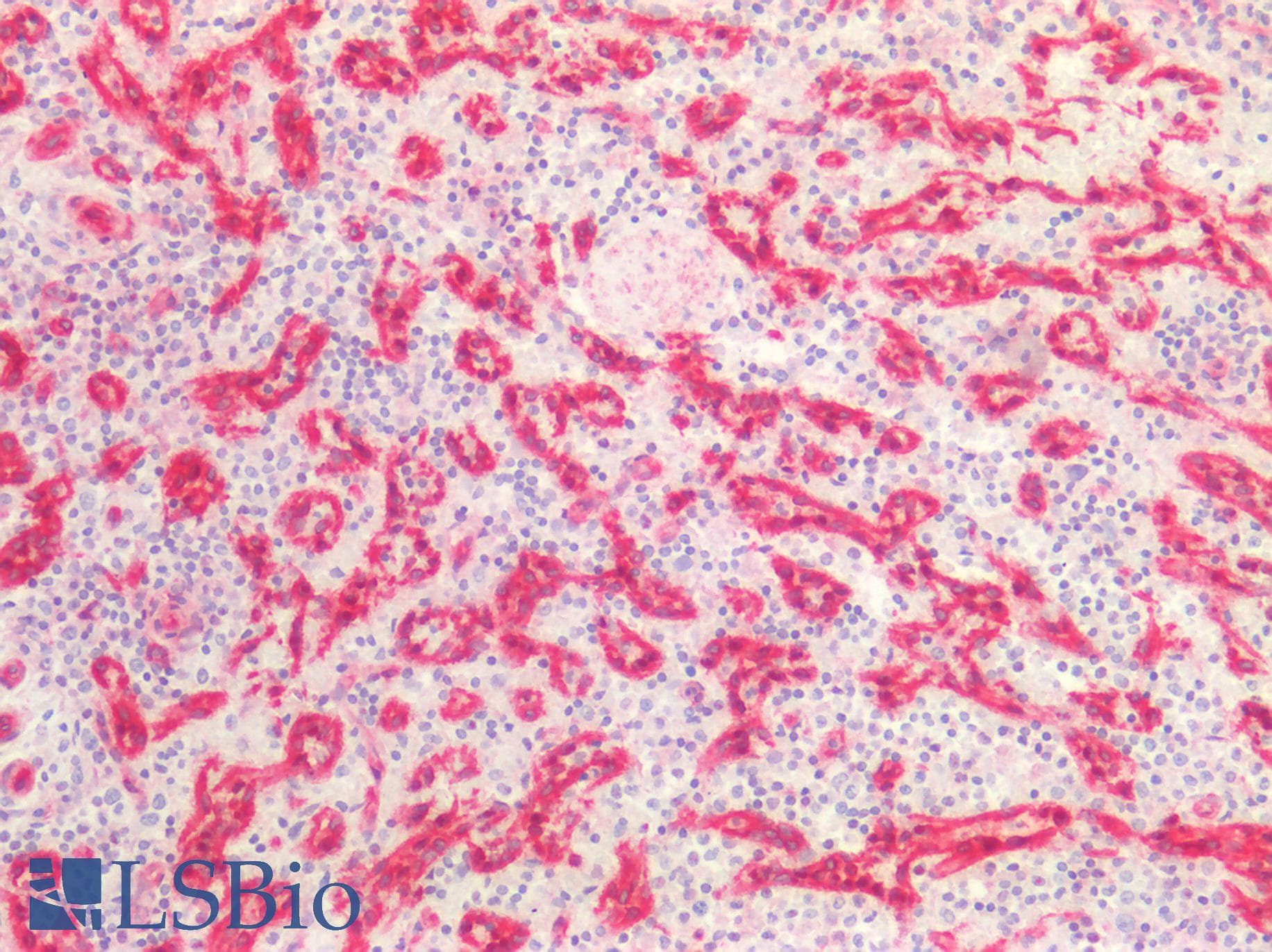 PathPlus™ CAV1 / Caveolin 1 Antibody (C-Terminus)