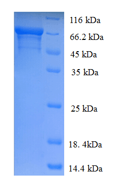 Human IDUA / MPS1 Protein (Recombinant His)