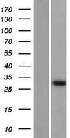 AUH Protein (Over-Expression Lysate Myc-DDK (Flag))