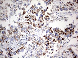 NDUFS2 Antibody (aa205-463, clone OTI1D5, Carrier-free)