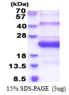 Human SMCP Protein (Recombinant His)
