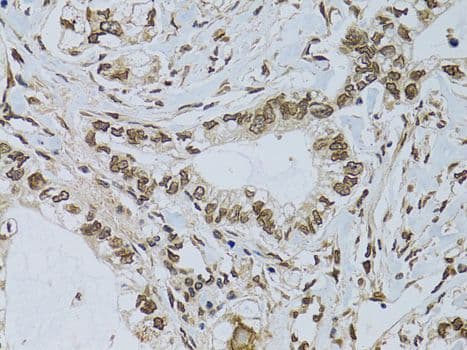 EMD / Emerin Antibody