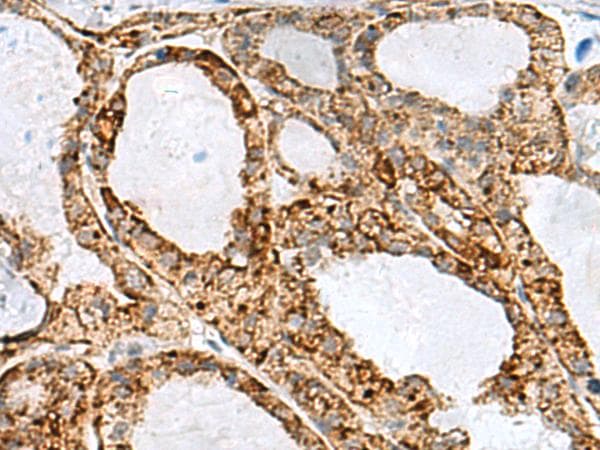 MED31 Antibody