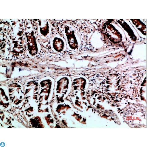 Polyclonal Rabbit anti-Human VHL / Von Hippel Lindau Antibody (IHC)