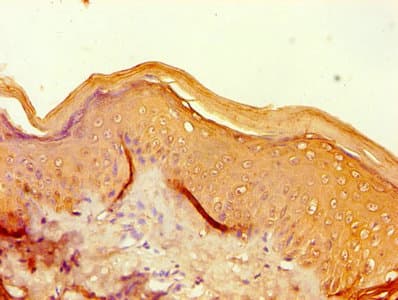 FLG / Filaggrin Antibody