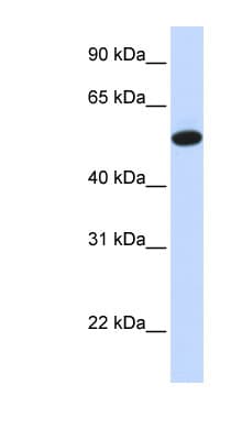 Polyclonal Rabbit anti-Human CEAL2 / CEACAM16 Antibody (aa337-386, WB)
