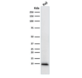 Ubiquitin Antibody (clone UBB/1748)