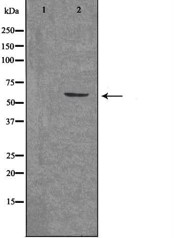 Polyclonal Rabbit anti-Human ARX Antibody (IF, WB)