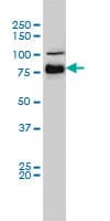 BRAF / B-Raf Antibody (clone 3C6)