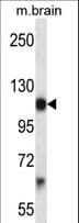 PDGFRA / PDGFR Alpha Antibody (aa678-706)