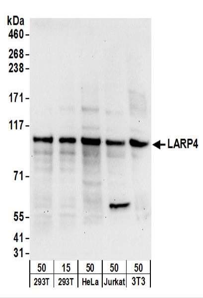 LARP4 Antibody (aa674-724)