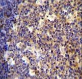 ALOX12B Antibody (aa622-652)