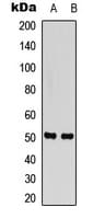 SLC38A2 / SNAT2 Antibody (Internal)