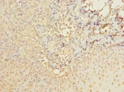 Polyclonal Rabbit anti-Human ABI3 Antibody (IHC, WB)