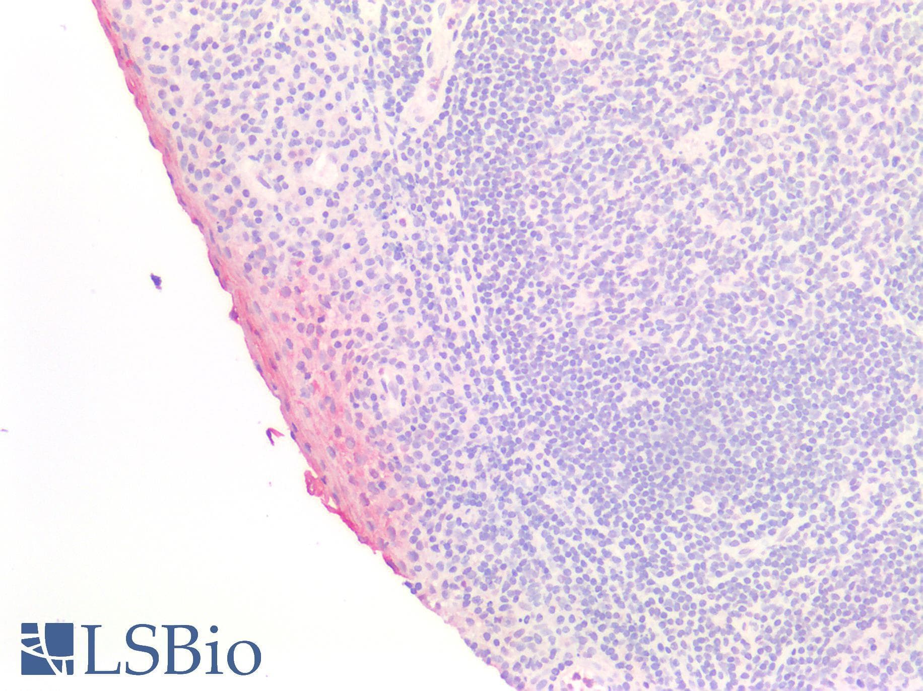 PathPlus™ Polyclonal Rabbit anti-Mouse ANXA1 / Annexin A1 Antibody (aa2 - 346, IHC, WB)