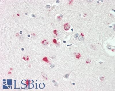 IHC-plus™ Polyclonal Rabbit anti-Human APLP2 Antibody (aa256-295, IHC, WB)