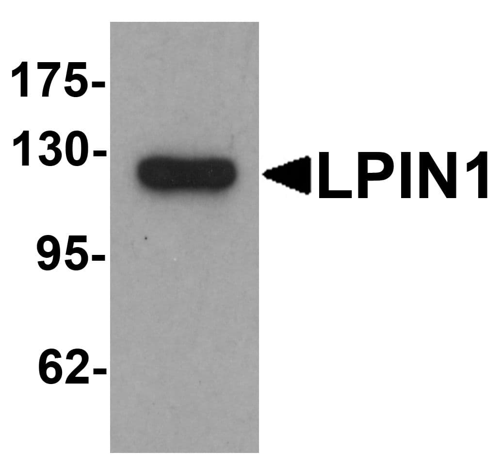 IHC-plus™ LPIN1 / Lipin 1 Antibody