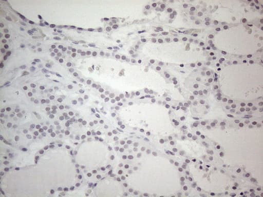 TDG / Thymine DNA Glycosylase Antibody (aa160-253, clone OTI3C11)