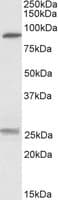 IHC-plus™ SLC4A11 / NABC1 Antibody (aa136-150)