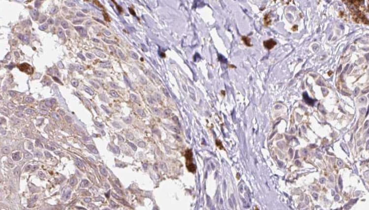 Polyclonal Rabbit anti-Human I-309 / CCL1 Antibody (IHC, WB)