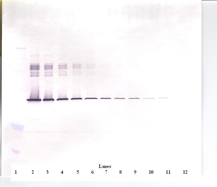 IHC-plus™ SERPINE1 / PAI-1 Antibody