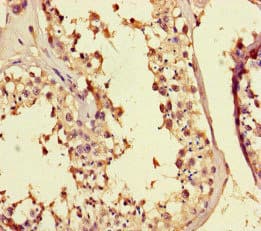 MED25 Antibody