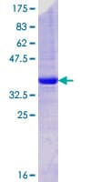 Human STEAP2 Protein (Recombinant GST, N-terminus)