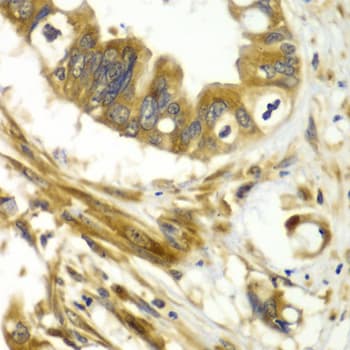 GBP1 Antibody