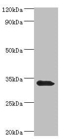 Polyclonal Rabbit anti-Human UCP1 / UCP-1 Antibody (aa1-307, IHC, WB)