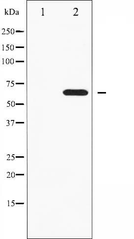 FRS2 Antibody (phospho-Tyr436)
