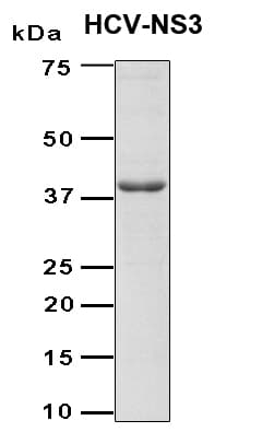 Hepatitis C Virus HCV NS3 Protein (Recombinant TRX-6His, N-terminus)