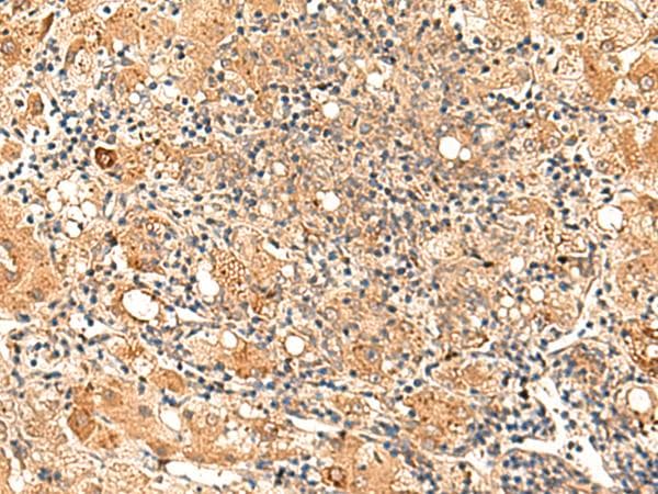 GALNT12 Antibody