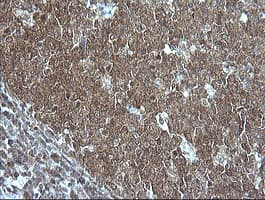 MAP2K1 / MKK1 / MEK1 Antibody (clone OTI3H3)