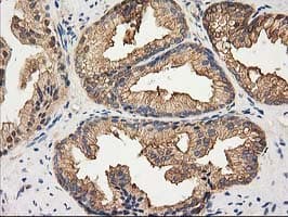 HDAC6 Antibody (clone OTI3E7)