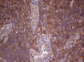 Monoclonal Mouse anti-Human ARFL3 / ARL3 Antibody (clone OTI1C6, aa2-182, IHC, WB)