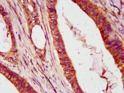 ISG54 / IFIT2 Antibody