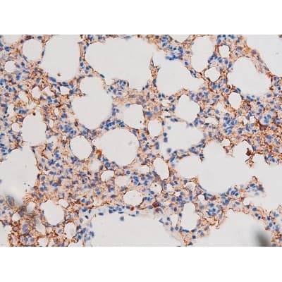 STAT1 Antibody (phospho-Ser727)