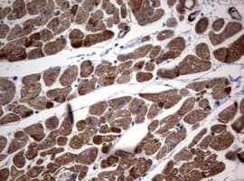 Hamartin / TSC1 Antibody (clone OTI3A2)