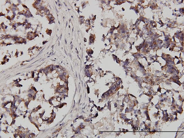 Monoclonal Mouse anti-Human FXR1 Antibody (clone 2G11, IHC, WB)