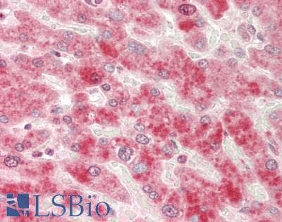 IHC-plus™ ACVR1B / ALK4 Antibody (Internal)