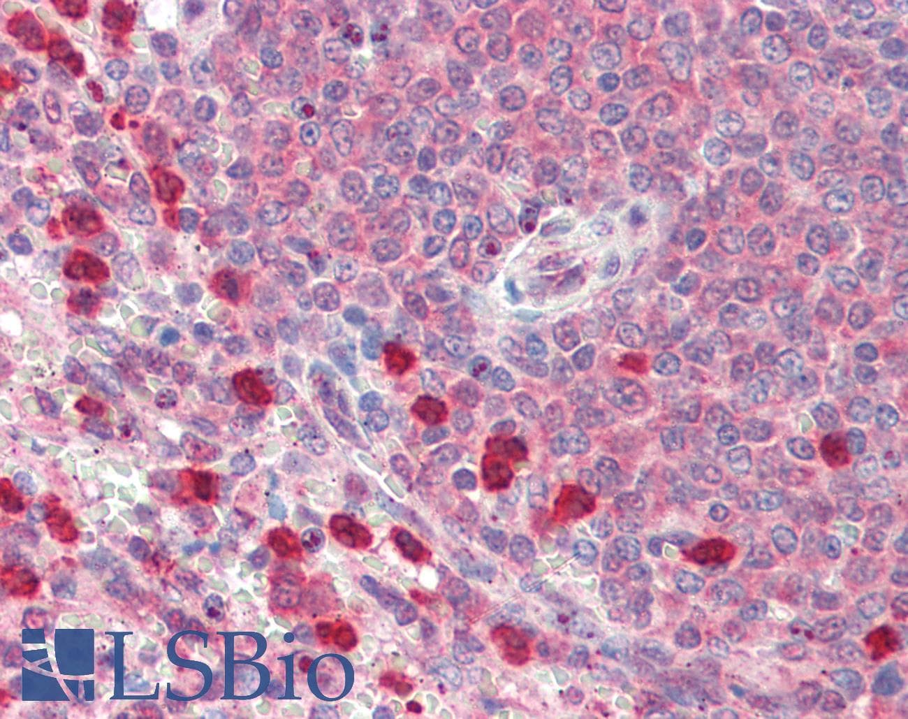IHC-plus™ P4HA1 Antibody (aa431-443)