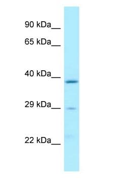 Latexin / MUM Antibody (aa69-118)