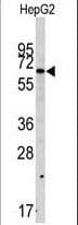 SWAP70 Antibody (aa227-256)