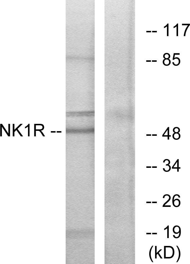 TACR1 / NK1R Antibody