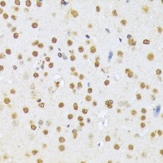 Polyclonal Rabbit anti-Human A1CF / ACF Antibody (IHC)