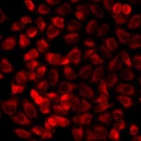 IHC-plus™ RAMP3 Antibody