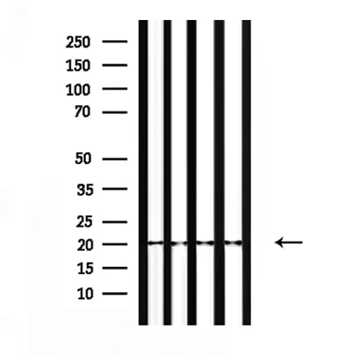 NTS / NT / Neurotensin Antibody